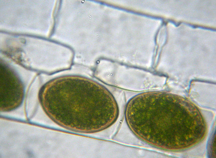 Alghe 3: Spirogyra sp